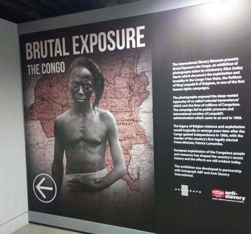 Image of Congolese man with injured wrist at entrance to exhibition